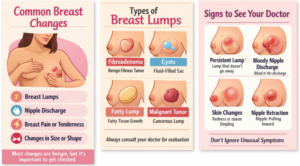 Common Breast Changes
