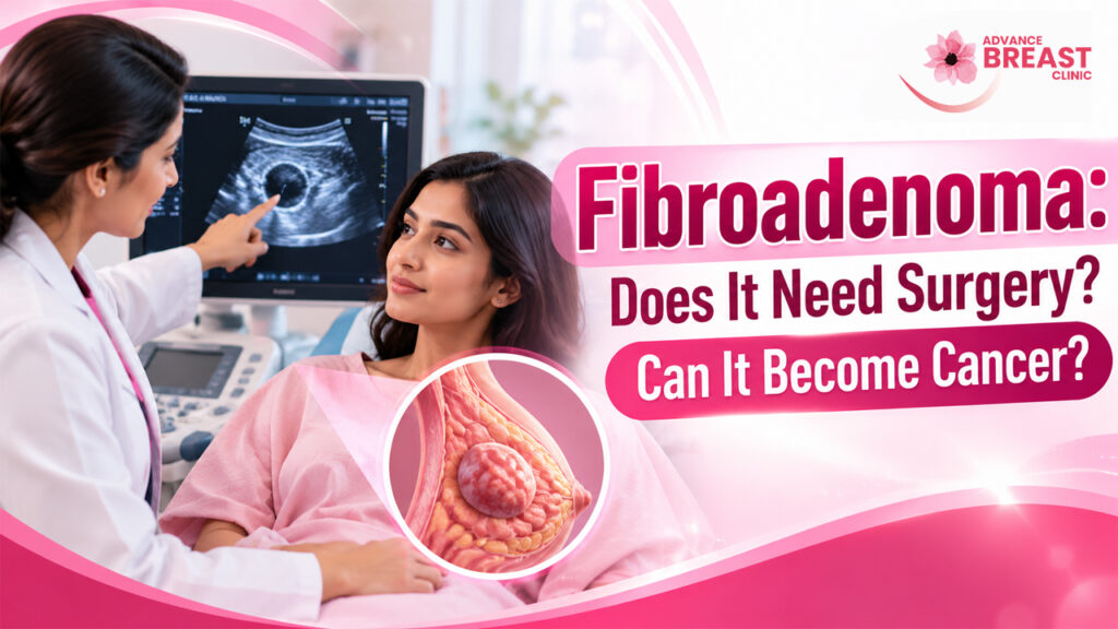Fibroadenoma: Does It Need Surgery? Can It Become Cancer?
