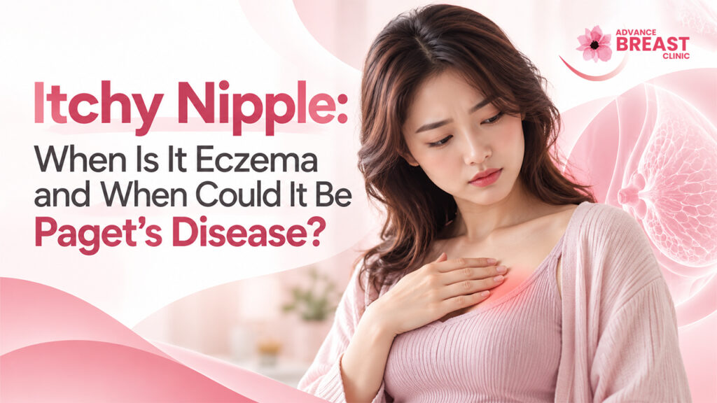 Itchy Nipple: When Is It Eczema and When Could It Be Paget’s Disease?